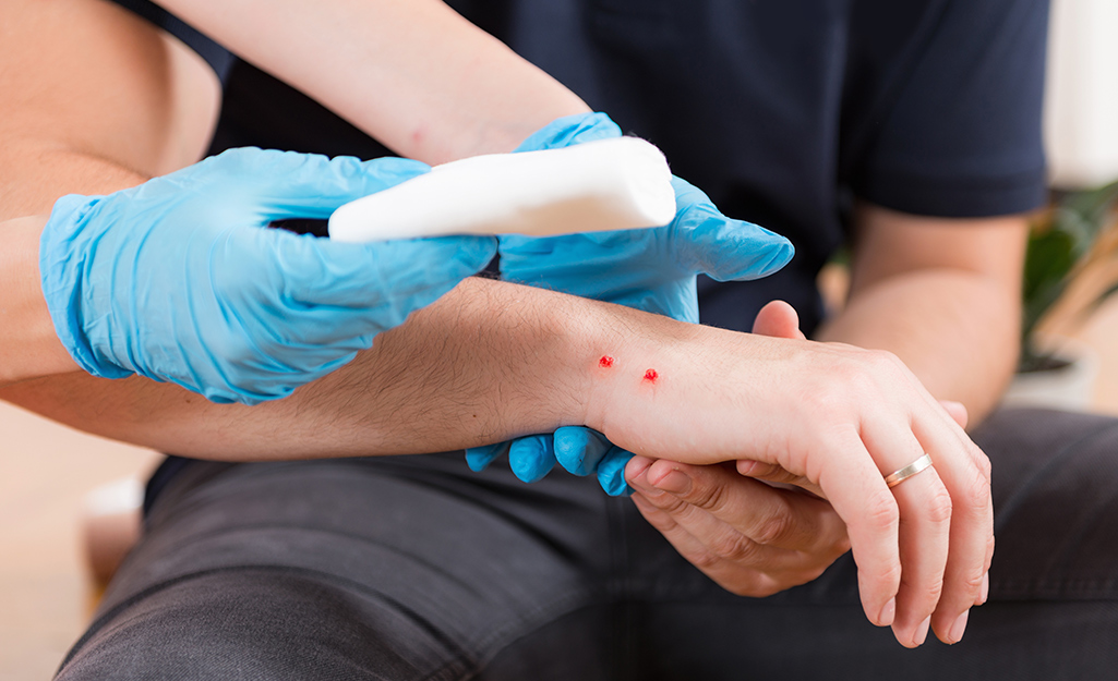 Person treating a snake bite.